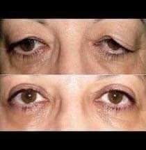 EL SECRETO PARA LEVANTAR TUS PÁRPADOS CAÍDOS. TE VAS A SORPRENDER CON LOS RESULTADOS FB IMG 1685817237594