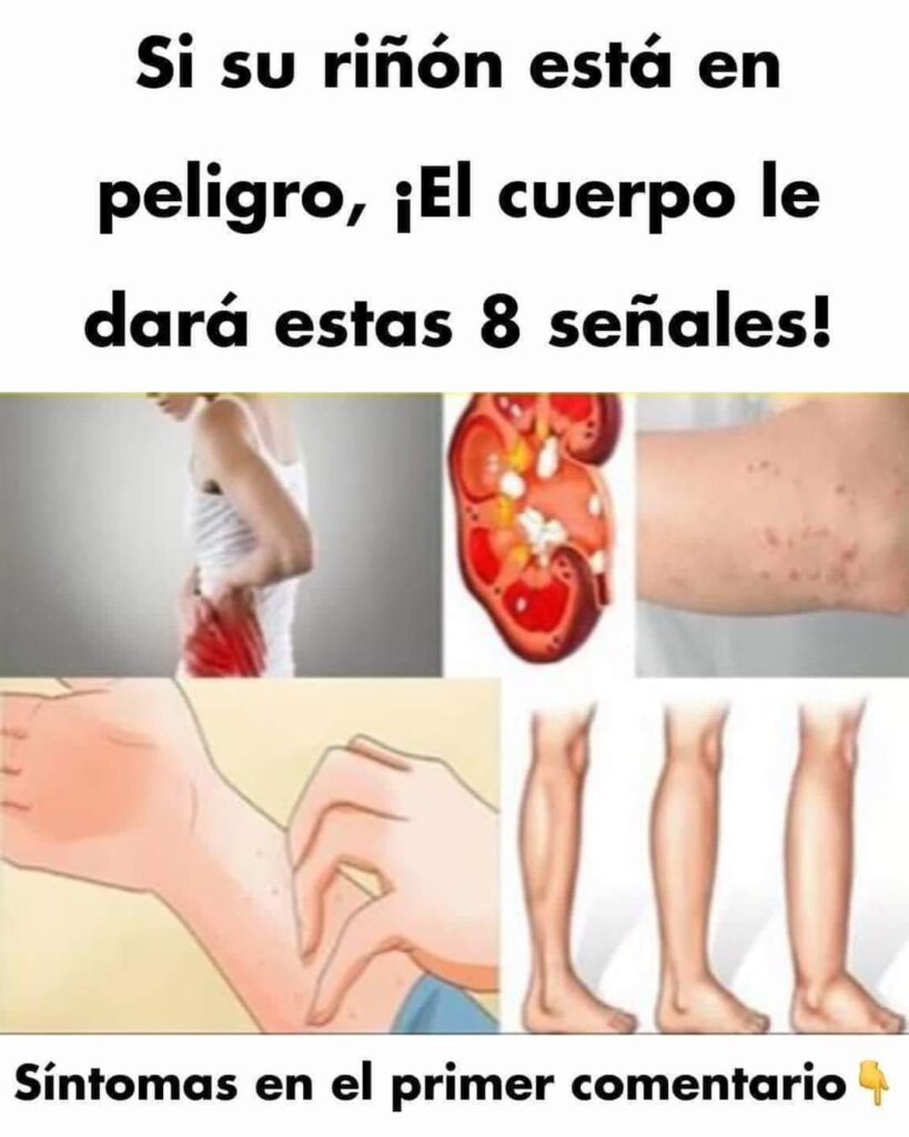 SI TUS RIÑONES ESTÁN EN PELIGRO, TU CUERPO TE DARÁ ESTOS 8 SIGNOS FB IMG 1686072854232 819x1024